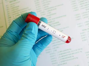 WHO Waspadai Tingginya Pertumbuhan Kasus HIV di Eropa