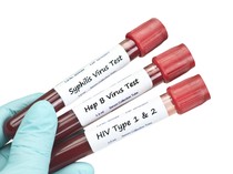 Hati-hati, 5 Bahaya Kesehatan karena Makan Makanan Bekas Orang Lain