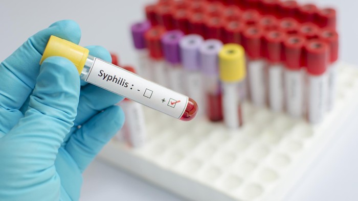 STD Blood Tests