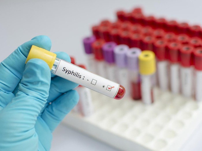 Studi: Kematian Akibat Seks Tak Aman Lebih Ditakuti Dibanding Kecelakaan