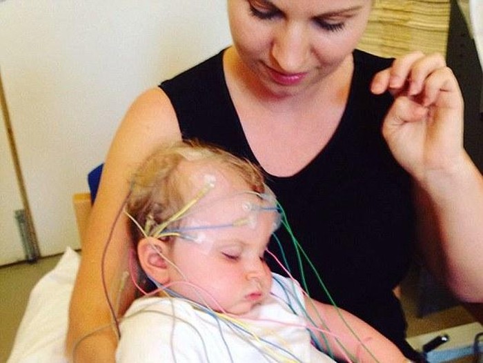 Bocah dengan Kelainan Genetik Langka Kejang Sampai 40 Kali Sehari