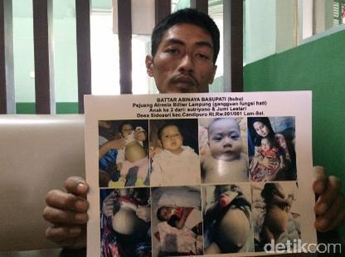 Satu Tahap Terlewati, Bayi Battar Hari Ini Jalani Cangkok Hati