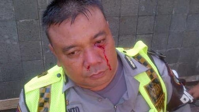 Kena Pukul Pendemo di HI, Wajah Anggota Polres Jakpus Bercucuran Darah