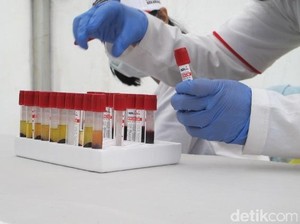 Heboh 414 Mahasiswa Positif HIV, KPA Bandung: Itu Data Akumulasi 1991-2021