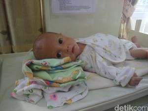 Azwar, Balita Kurang Gizi di Bengkulu yang Tubuhnya Dipenuhi Belatung