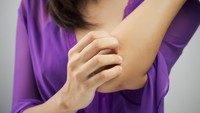 Mengenal Penyakit Alergi: Jenis, Gejala, hingga Cara Mencegahnya