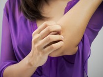 Kulit Seperti Melepuh dan Memerah, Gimana Cara Mengatasinya Dok?