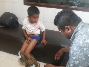 Bocah ini Jalan Sendiri ke Kantor Polisi Setelah Dipukuli Bapak dan Ibu Tiri