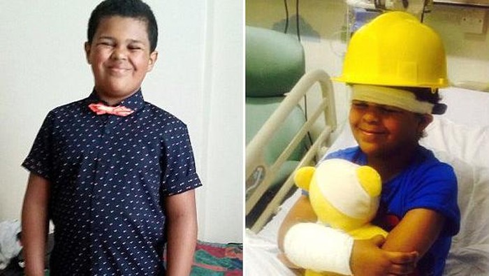 Ngantukan dan Sering Sakit Kepala Karena Otak Melorot ke Tulang Belakang