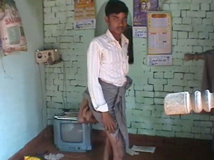 Kisah Pria dengan Dua Kaki Tambahan yang Sering Di-bully Orang