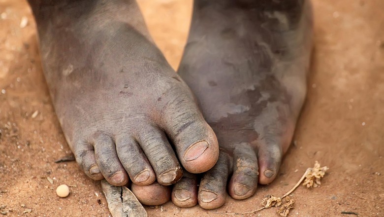 PBB Sebut 2,4 Juta Orang Butuh Bantuan Pangan di Mali-Niger PBB Sebut 2,4 Juta Orang Butuh Bantuan Pangan di Mali-Niger