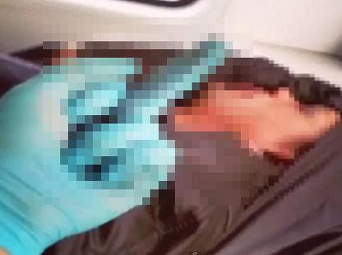 Foto Selfie Acungkan Jari Tengah ke Pasien Sekarat, Paramedis Ini Dipecat