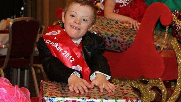 Kisah Bocah dengan Down Syndrome yang Puluhan Kali Juarai Kontes Kecantikan
