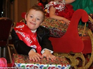 Kisah Bocah dengan Down Syndrome yang Puluhan Kali Juarai Kontes Kecantikan