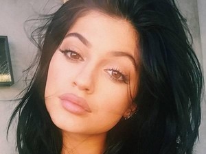 Apakah Bibir Tebal dan Penuh Mirip Kylie Jenner Tetap Diminati di 2016?