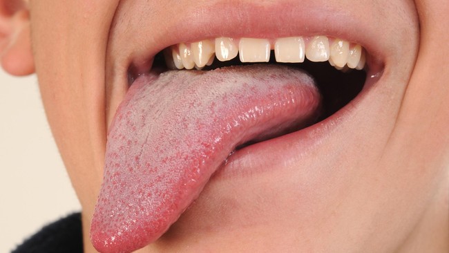 Sebab-sebab Mulut Terasa Pahit, Bukan Cuma Karena Sakit (2)