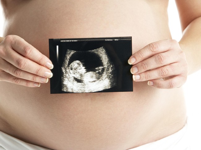 Para Ibu Hamil yang Rela Tunda Terapi Kanker Demi Pertahankan Bayinya