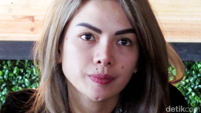 Nikita Mirzani Bisa Berdalih, Biar Polisi Bekerja