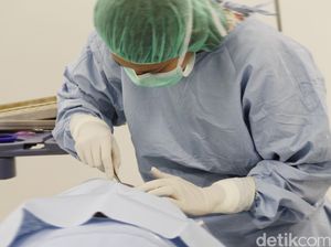 Demi Viral, Dokter Bedah Plastik Joget TikTok Sambil Pegang Potongan Tubuh