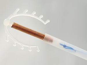 Ingin Pasang KB Spiral? Ini Jangka Waktu yang Disarankan Dokter Kandungan