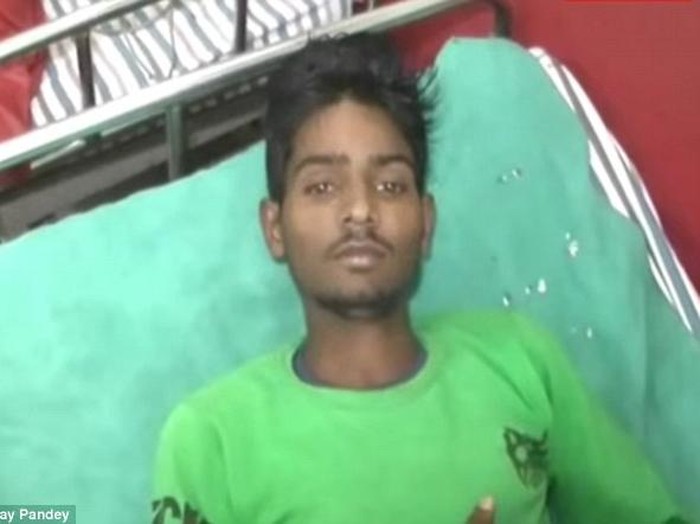 Sering Muntah dan Bobot Turun karena Janin Kembaran Bersemayam di Perut