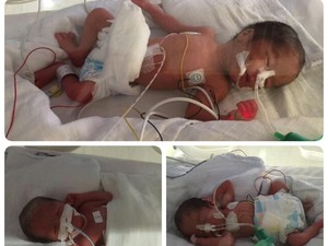 Bayi Kembar Lima dari Cirebon Inisial Namanya A, I, U, E dan O