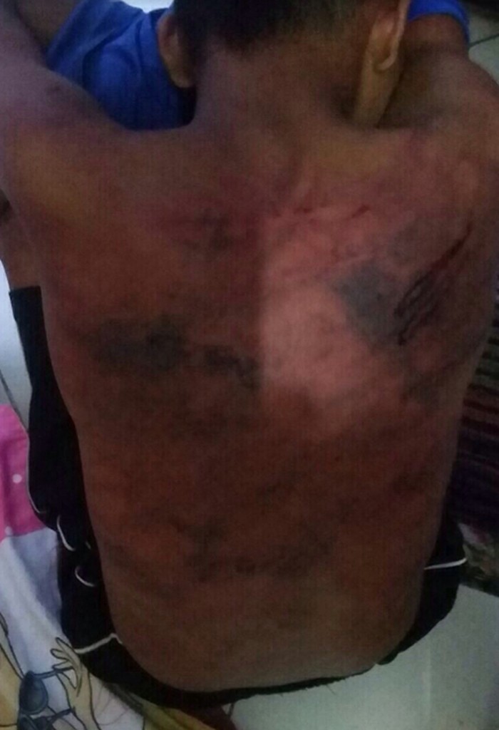 Dipukuli Marinir, Bocah T dan M Trauma dan Mesti Didampingi Psikolog