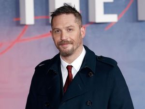 Tom Hardy Berdarah-darah Bintangi Venom