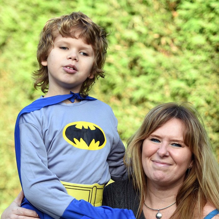 Dengan Penglihatan ala Kelelawar, Ruben Akhirnya Bisa Melihat Dunia