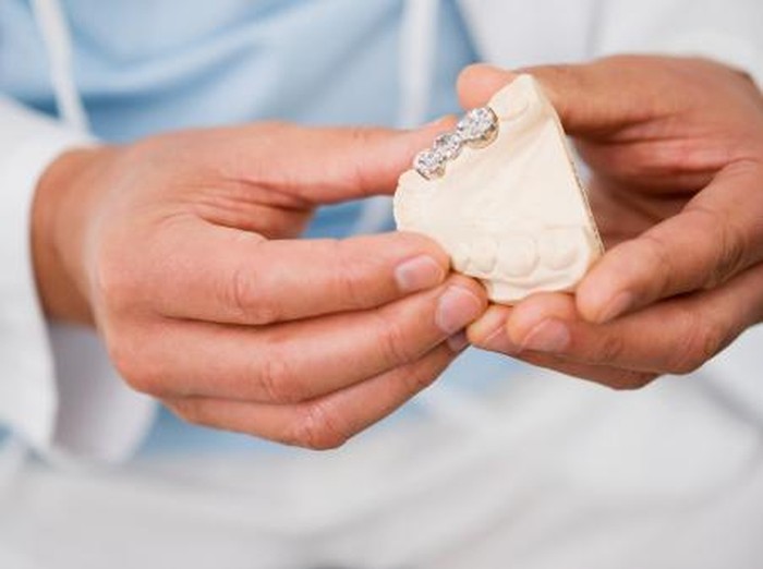 Amalgam, Tambal Gigi Bermerkuri yang Pernah Populer