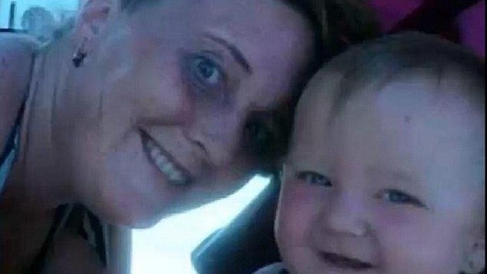 Tanda Lahir Meledak, Wanita Ini Ternyata Punya Tumor