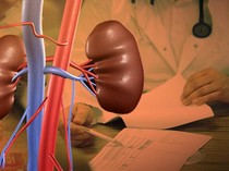 Kesaksian Pilu Warga Myanmar Terpaksa Jual Ginjal Ilegal demi Bertahan Hidup