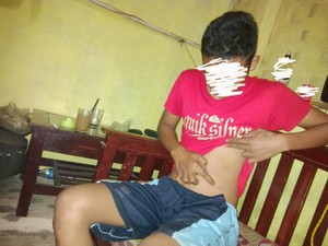 Ini Alasan 2 Warga Majalaya Nekat Jual Ginjal: Jeratan Utang