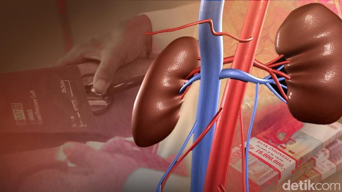 Pengacara Sebut Ada Komunikasi Antara Pelaku dan Dokter di Kasus Jual Ginjal