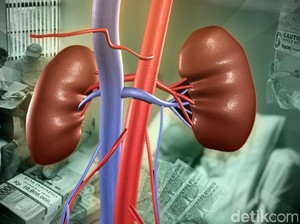 Modus Sindikat Penjual Ginjal: Palsukan KTP dan Permak Korban Tampil Muda