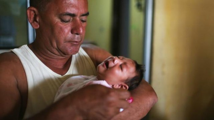 Begini Rasanya Terkena Virus Zika