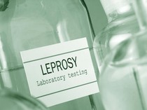 Kemenkes Beberkan Kondisi 2 WNI di Rumania yang Tertular Kusta dari Ibunya di Bali