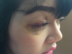 Cerita Sopir Masinton Soal Perjalanan Dita Hingga Mengaku Dipukul