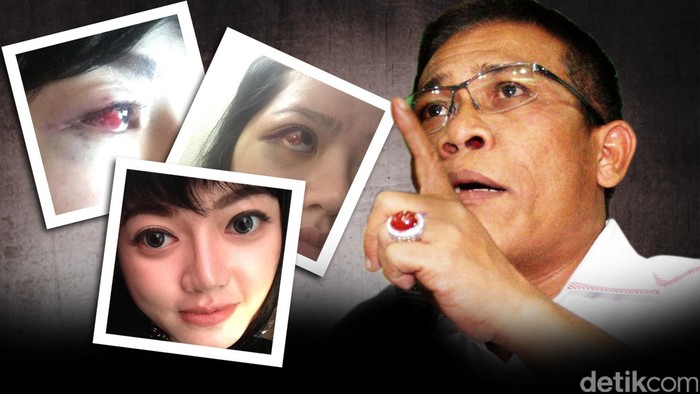 Pimpinan Komisi III Klarifikasi Masinton Soal Laporan Penganiayaan Dita