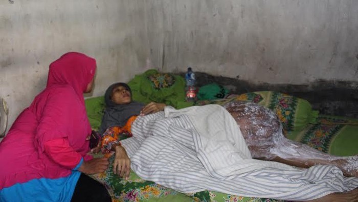 Eli, Penderita Kanker di Kaki Butuh Bantuan