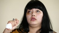 Sambil menangis, Dita menceritakan penganiayaan yang dilakukan Masinton kepada awak media.