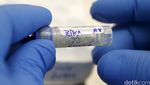 Mengenal Nyamuk Pembawa Virus Zika