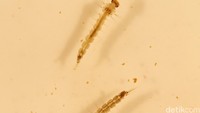 Ini dia larva Aedes Aegypti pembawa virus Zika. Jaime Saldarriaga/Reuters/detikFoto.