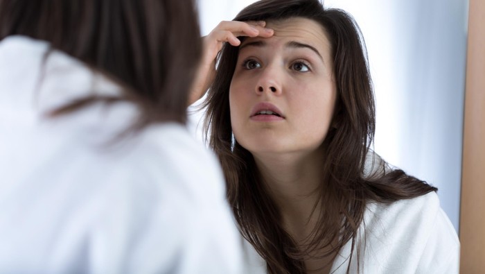 Ilustrasi seorang wanita yang punya jerawat di dahi