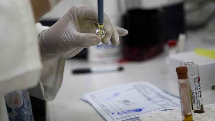 Kasus di AS: Virus Zika Ditularkan Melalui Hubungan Seks