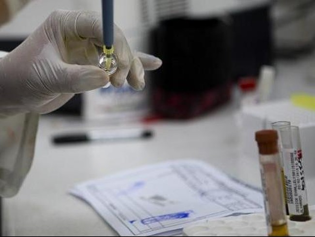 Epidemi Disease X Mengintai, Ini Hal-hal yang Perlu Dipersiapkan