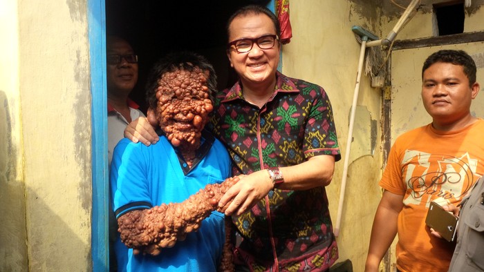 Bantu Operasi Pak Urip, Tantowi: Niat Baik Saya Terlaksana