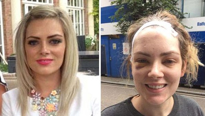 Dikira Pusing Karena Urus 4 Anak, Wanita Ini Ternyata Punya Tumor Otak