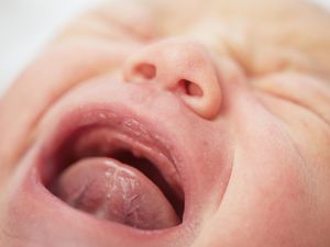 Perlu Tahu! 4 Tipe Tongue Tie yang Bikin Bayi Susah Menyusu