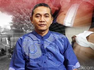 Aiptu Budiono: 3 Peluru Menembus Tubuh, Merusak Usus dan Paru-paru